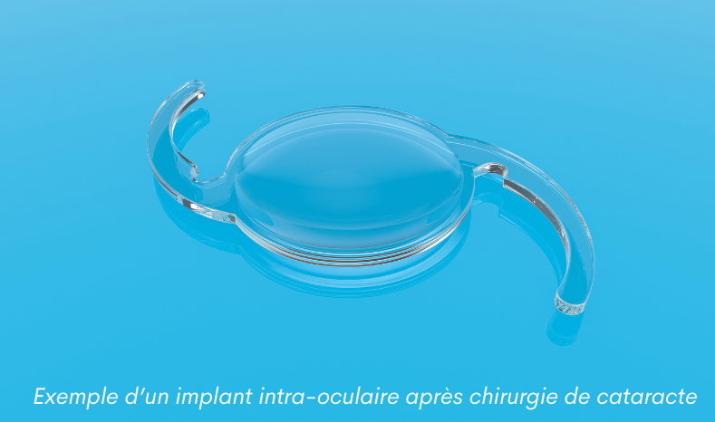 Image d'un implant intraoculaire